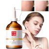 100 мл отбеливающая сыворотка для удаления веснушек, хлоазмы, осветления темных пятен, светлых пятен, пятен Hyper B9M7
