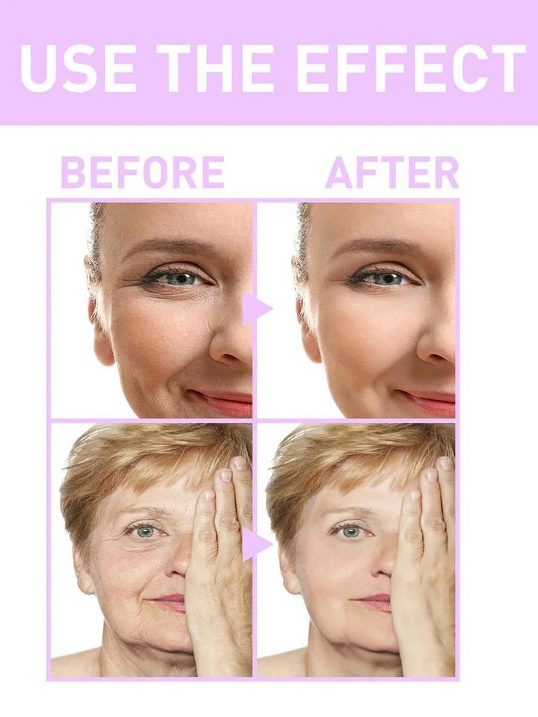 Крем с ретинолом для лица, морщин, тонких линий и гиперпигментации, ночной крем с ретинолом с ацетил гексапептидом-8 и гиалуроновой кислотой