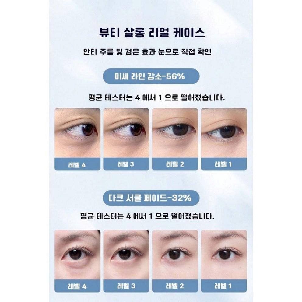 Eye Cream for Under Eye Bags Lifting, Dark Circles, Wrinkles, and Volume Improvement (20ml)
