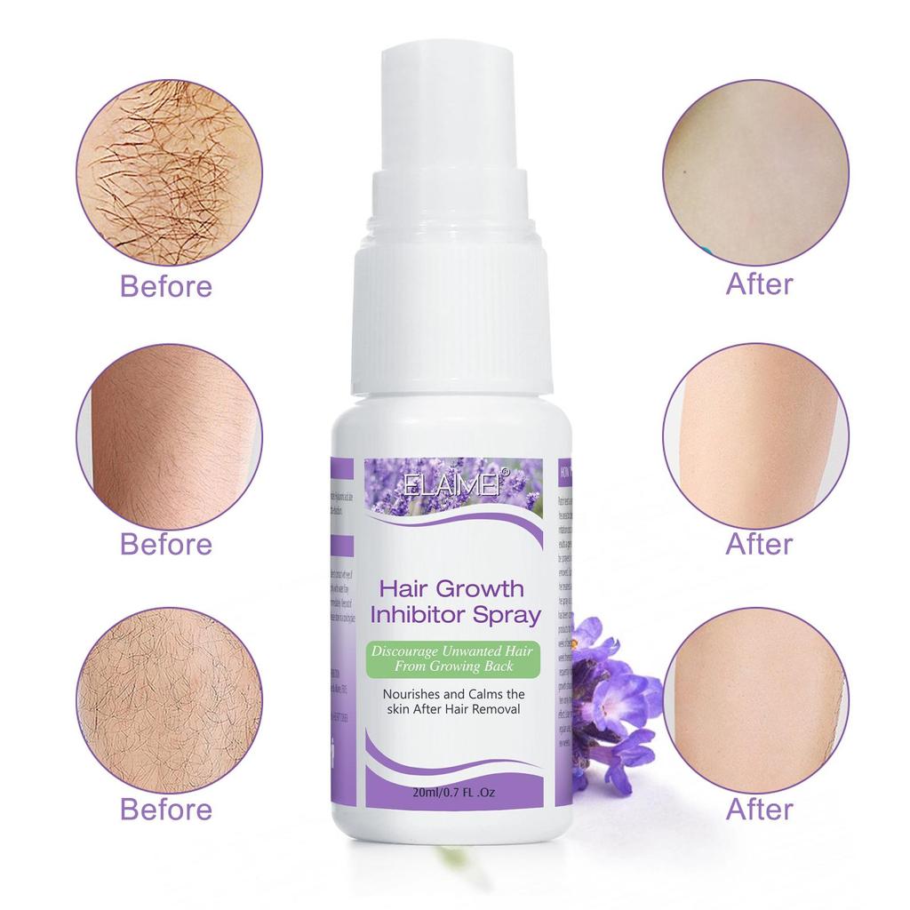 Ингибитор роста волос, спрей для остановки роста волос, борода, бикини, интимные места, ноги, подмышки, безболезненное средство для остановки волос на лице, 20 мл