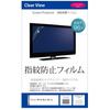 Аксессуары для ноутбуков – Защитные пленки для экранов ноутбуков
