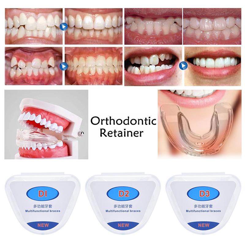 Dental Straightener Adult Fixed Silicone Braces Anti-Grinding Braces