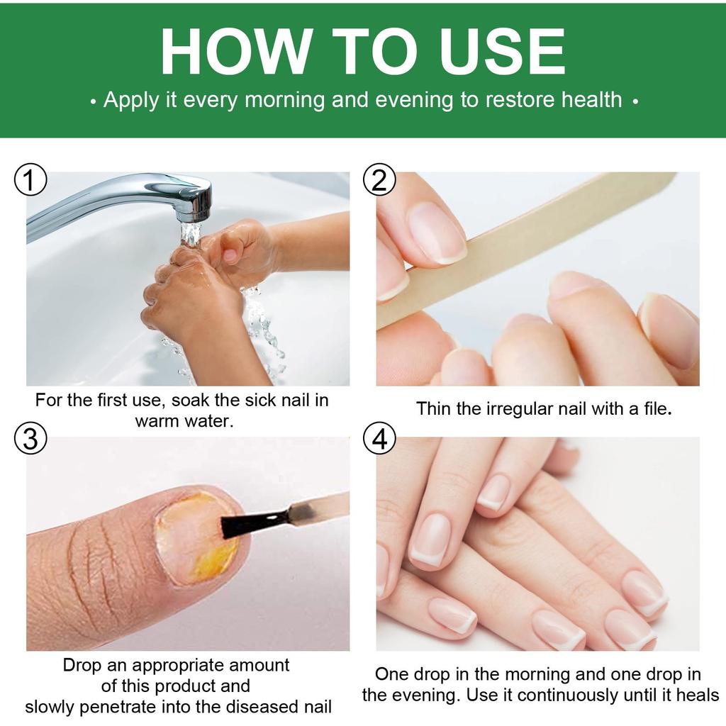 30ml Nail Repaird Solution, FootNail Tea-Tree Oil, Thick And Soft Nail Nutrition Hand And Foot Nail Care Solution