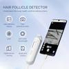 50X/200X Magnifying Mini Hair Follicle Scalp Detector Portable Skin And Hair Eetector Skin Tester Skin Analyzer Pore Magnifier
