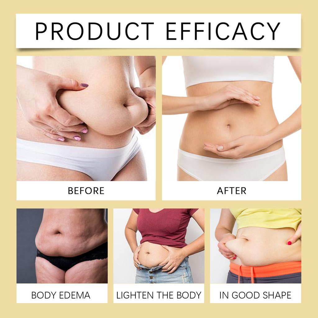 Премиальные пластыри для похудения с пчелиным ядом для подтяжки кожи и уменьшения жира на животе для женщин