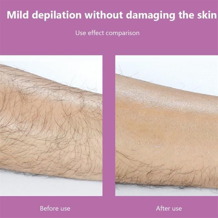 Blue - Physical Epilation Crystal Epilator Rubber Safety Epilator Reusable Easy To Clean Body Bea