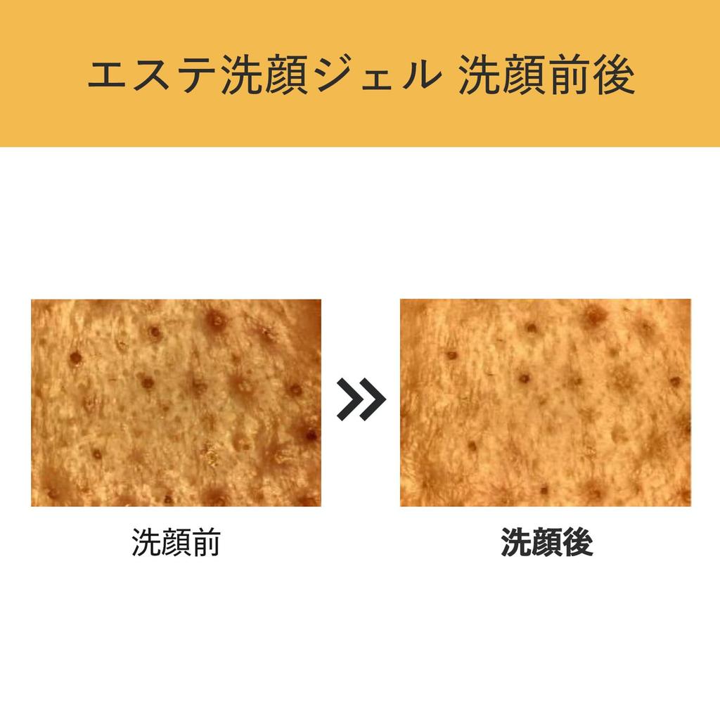 AQUALABEL Эстетический гель для умывания лица для пор, средство для снятия макияжа с лица 130 г, формула «дыхания» от черных точек, уход, очищение,