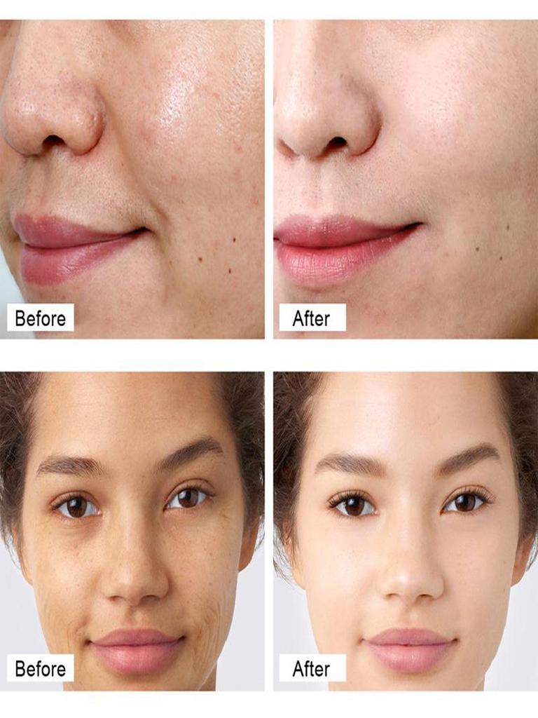 Whitening Freckle Cream Effective Remove Melasma Dark Spots Cream Fade  Moisturize Brighten Smooth Beauty Face Skin Care