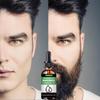 5ML/15ML/30ML/50ML/NEW Beard Hair Growth Essential Oil Anti Hair Loss Product Natural Mustache Regrowth Oil for Men Nourishing Beard Care Roller