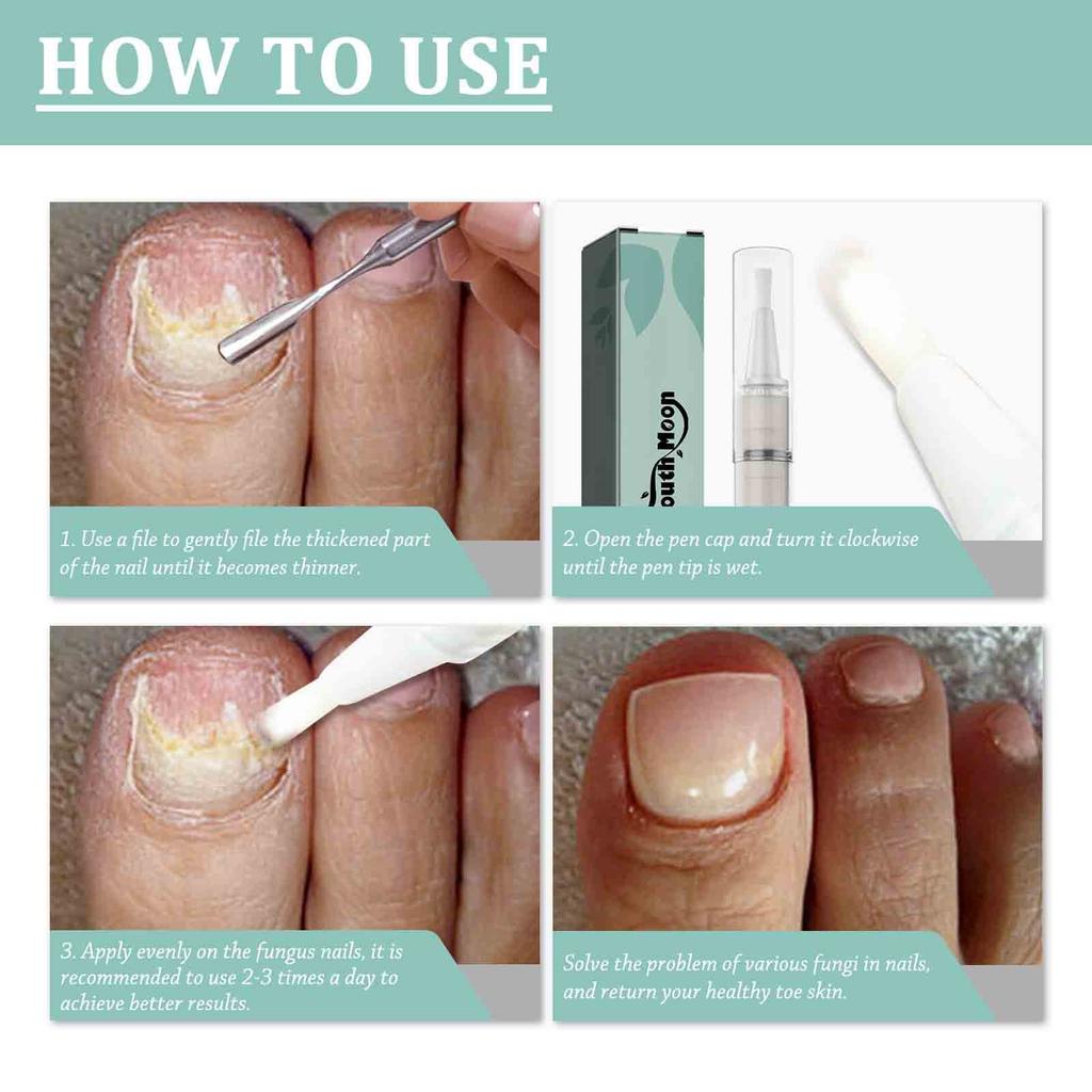 Nail TreatmentPen, Nail Cuticle Oil, Damaged Nail Pen, Nail Strengthening CuticleSwitch, AloeVera And TeaTree Oil RepairDamaged,3ml