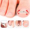 2PCS Curved Design Ingrown Toenail Corrector Adjustable Toenail Straightener Tool  Nail Correction