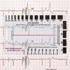 Transparent 7-Step Ruler Measuring Tool Waterproof Compact Design ECG-Interpretation Pocket Reference Guide