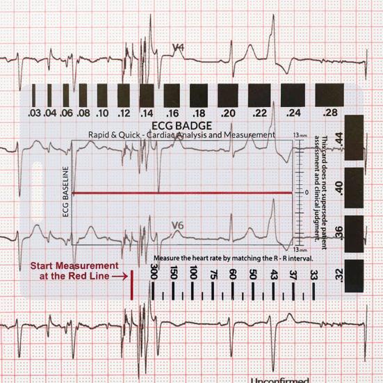 Transparent 7-Step Ruler Measuring Tool Waterproof Compact Design ECG-Interpretation Pocket Reference Guide
