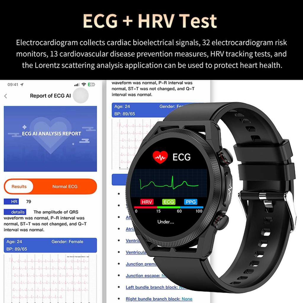 SACOSDING кровяное давление умные часы мужские ЭКГ + ППГ + ВСР Bluetooth вызов кислорода в крови монитор артериального давления женские спортивные умные часы