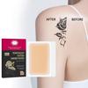 Skin Unseeable Concealer Patch,Waterproof Sweatproof Ultra Thin  Concealer Patch Cover Up Tape Breathable Real Skin,Scar,Dark Spots,Birthmarks(6patch)