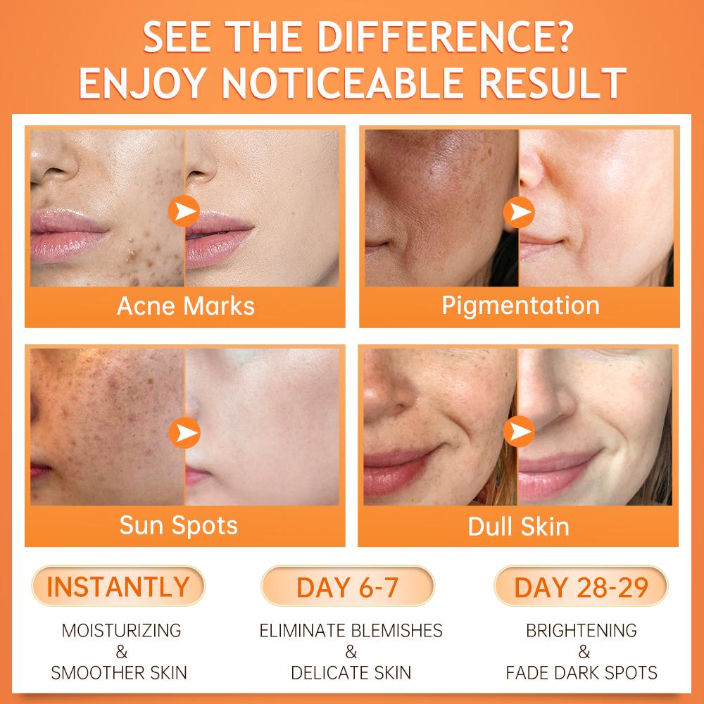 JellyPrim Сыворотка с витамином С, питательный уход за кожей, гиалуроновая кислота, исчезающие пятна от прыщей, увлажняющий продукт для лица, отбеливающая косметика для выцветания пятен