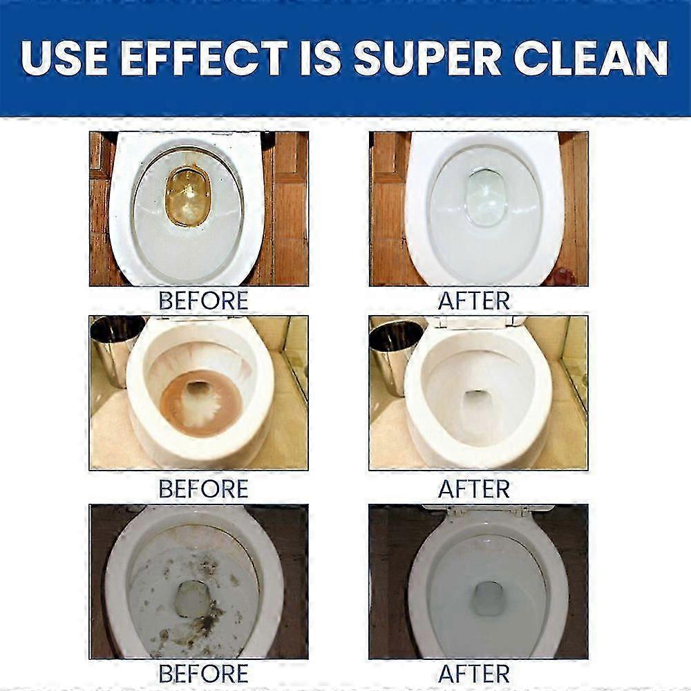 New Toilet Cleaner Tabs Cistern, Extra Strong Descaler For Sanitary, Especially Stubborn Limescale And Urine Stone