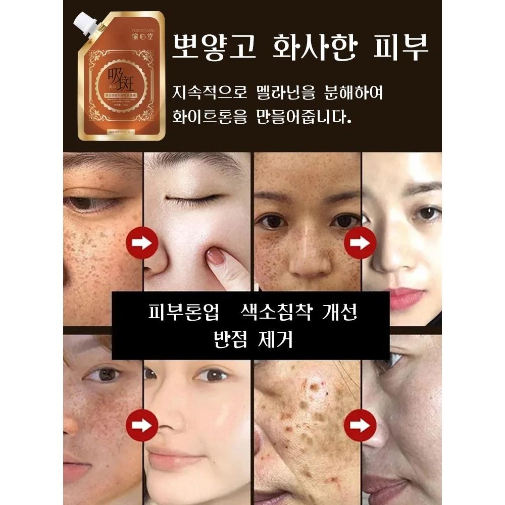 100Ml+100Ml 2 Week Spot Removal Anti-Aging Mask Wrinkle Improvement Whitening Mask Brightening Mask Pack, 2 Pieces: 100Ml+100Ml