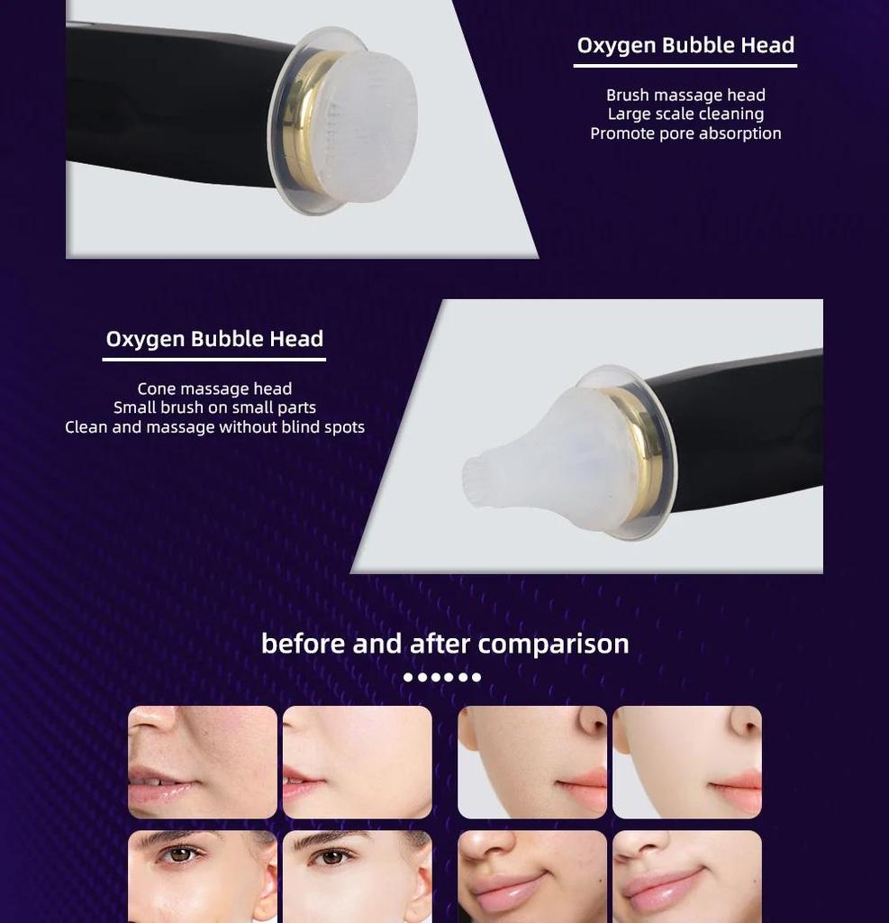 2025Обновление кислородной пузырьковой ручки CO2 кислородный портативный аппарат для ухода за кожей лица, CO2 гель для ухода за кожей лица, СПА для лицаOxygen Beauty