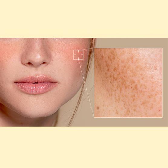 Easydew Mela B Тонизирующая УФ-сыворотка для загара 2X SPF 50+ PA++++ 40 мл