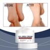 Urea Foot Cream,Urea Cream For Feet,Urea Foot Cream Foot Cream For Cracked Heels And Dry Skin Deep Moisturizing,Callus Remover Nourishes Soften