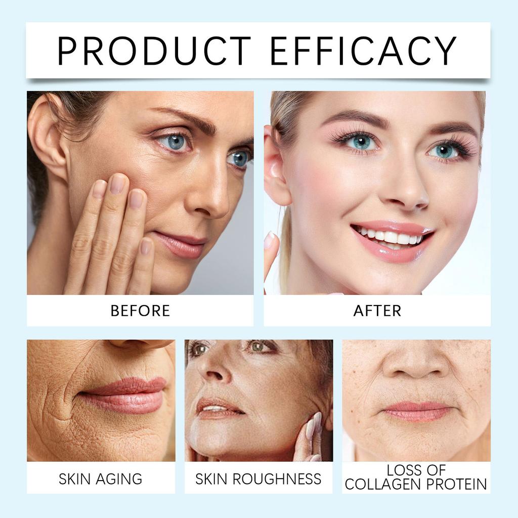 Гликолевая сыворотка для пилинга, сыворотка для лица, сыворотка для ухода за лицом, улучшает способность кожи к умеренному, легкая текстура, глубоко проникает в кожу, 30 мл