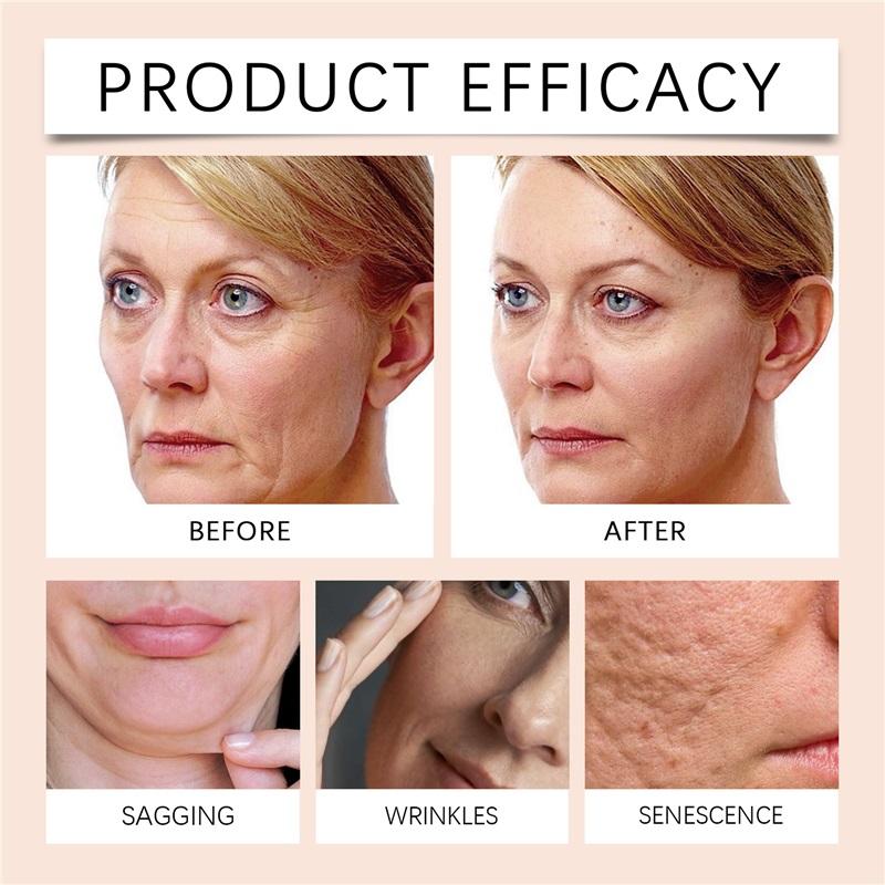 Hoygi Retinol Bee Venom Facial Capsules Gently Moisturize Facial Skin, Tighten and Improve Skin Quality, Moisturizing Capsules