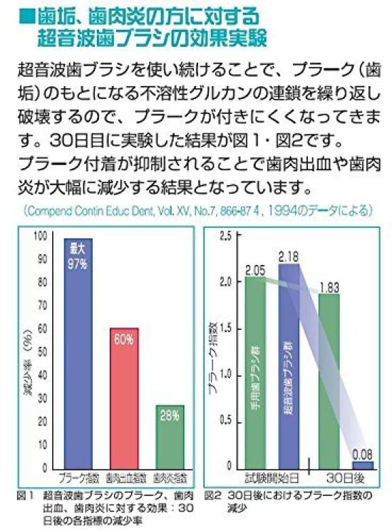 Ультразвуковая электрическая зубная щетка Smile X лавандового цвета с 2 упаковками сменных зубных щеток 1,6 МГц AU-300D