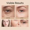 AMZ collagen eye cream, eye essence, eye care set, gentle moisturizing, light texture of eye skin, easy to apply, daily eye care 1set