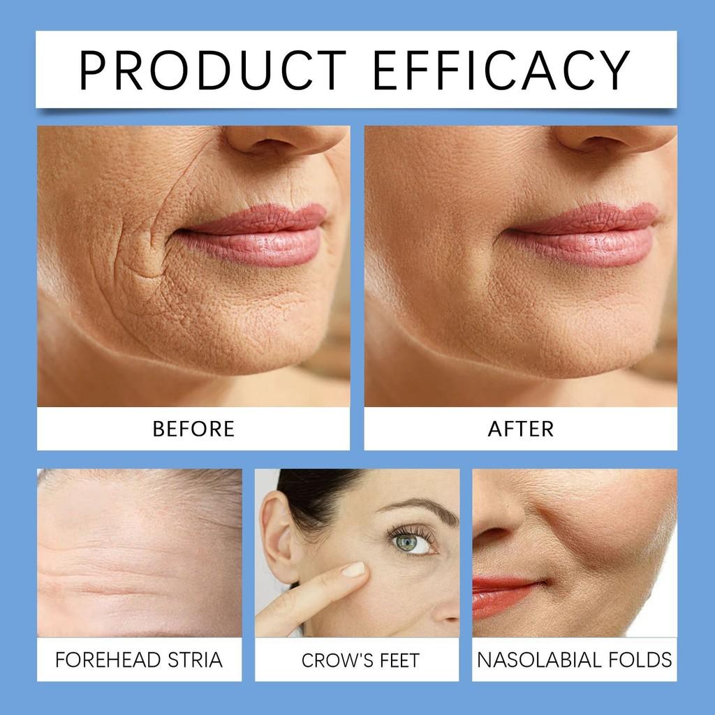 West Month Collagen Facial Essence Serum Hydrating Moisturizing Anti-aging Formula 30ml For Radiant Skin