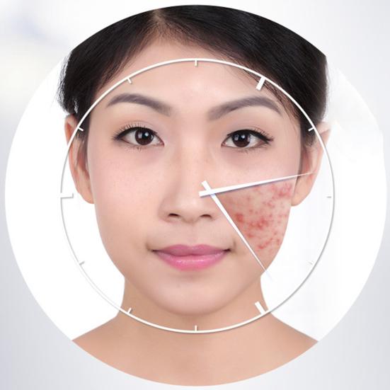 Pimples Removal Shrink Pore Moisturizing Skin Care Cream