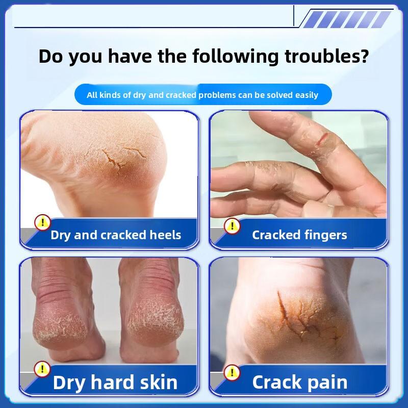 Organic Herbal Cream - Repair & Nourish Dry Cracked Hands & Feet