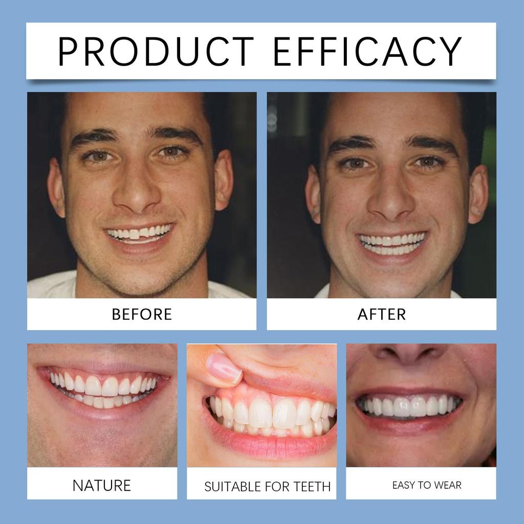 Взрослый регулируемый набор зубных протезов, зубы, накладные зубы, портативные брекеты, украшение для заполнения промежутков, улучшение эстетики улыбки, виниры, инструмент для красоты