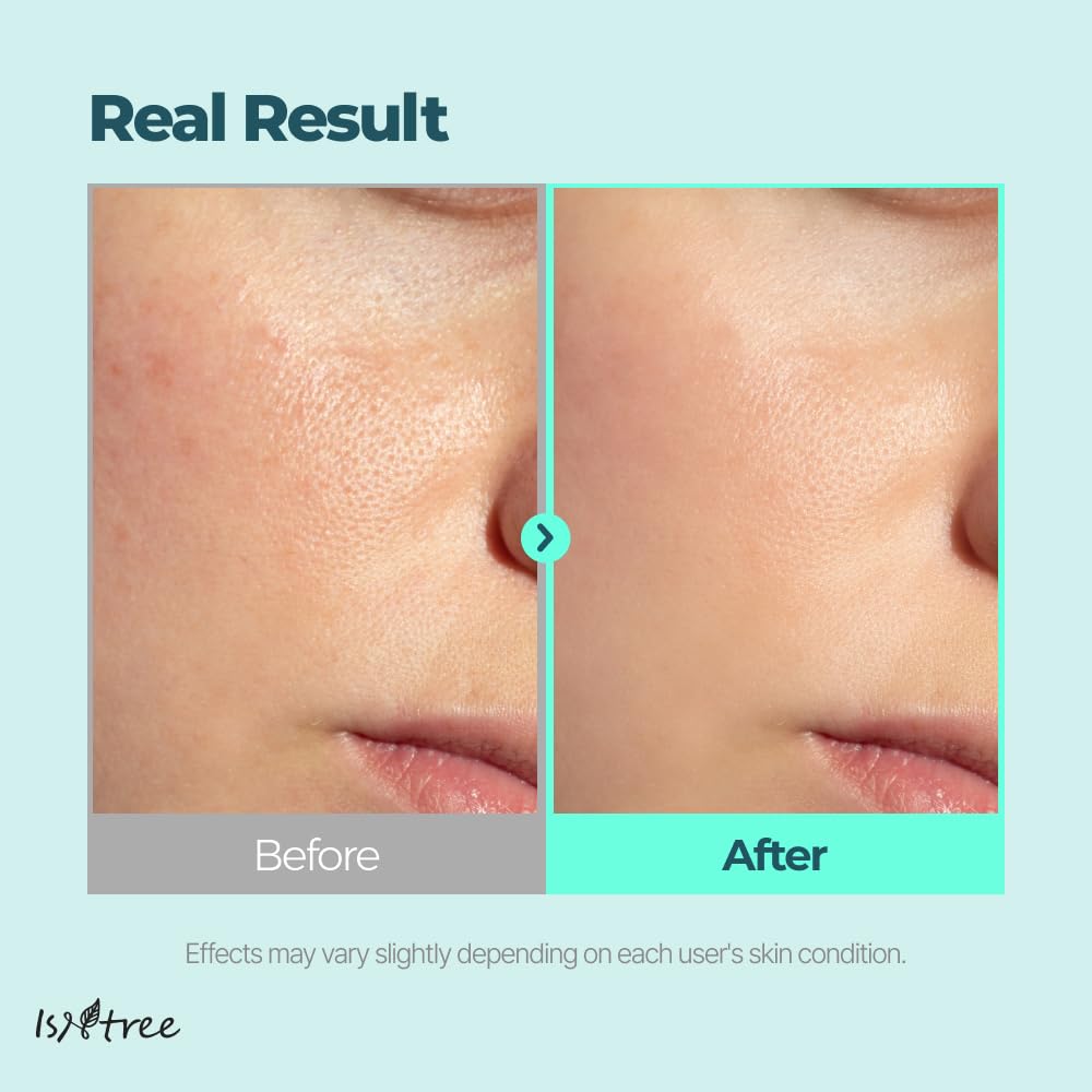 ISNTREE Seaweed PDRN Bouncy Ampoule 50ml, GIM Next-Generation Botanical PDRN Serum, Moisturizing and Hydrating