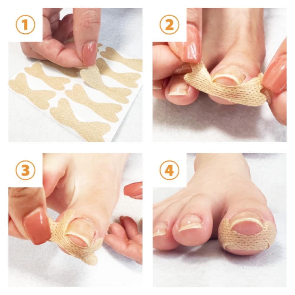 От вросшего ногтя Tsumerakku Лента для вросшего ногтя клейкая x дышащая Легкая вросшая лента для вросшего ногтя инструкции Foot Comfort Workshop