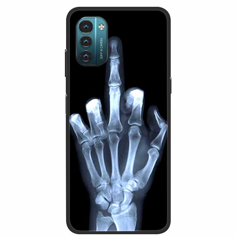 Чехол для Nokia G21 Nokia G11 Ударопрочный Мягкий силикон ТПУ Чехол для телефона Для Nokia G21 G 11 Задние чехлы Для Nokia G 21 Бампер