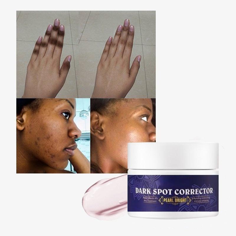 Удаление 7 дней Корректор темных пятен Уход за кожей Отбеливающий крем для лица от веснушек под частной торговой маркой