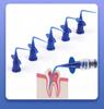 20/50Pcs Disposable Curved Tube Dispensing Nozzles with Wing Flange, Blue & Clear Plastic Liquid Transfer Lab Auxiliary Tips