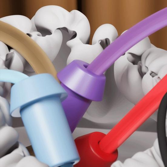 Kids Rope Untangling Game Logic Thinking Focus Training Rope Board Game Parent-children Interactive Educational Colorful Elastic Rope Unhitching Toy