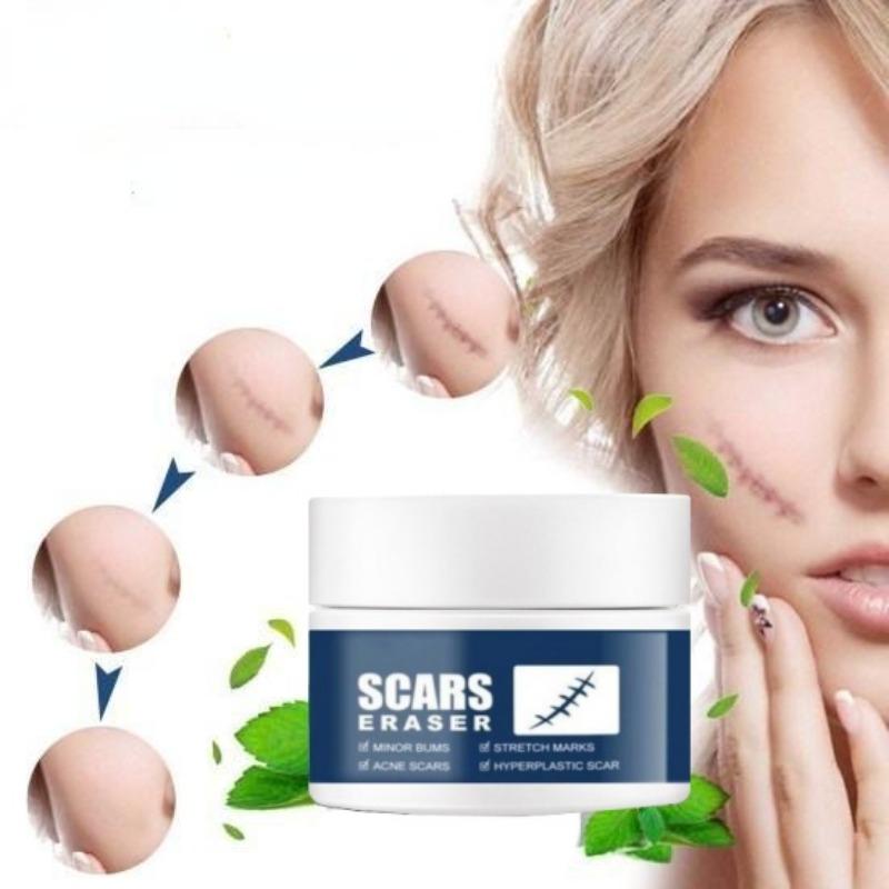 Не раздражающий восстанавливающий синтетический крем для удаления шрамов