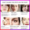 Новейший крем-корректор темных пятен, отбеливающий крем для лица, ремонт, выцветание веснушек, удаление темных пятен, средство для удаления меланина, осветляющий крем для лица